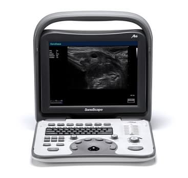 Sonoscape A6 Ultrasound